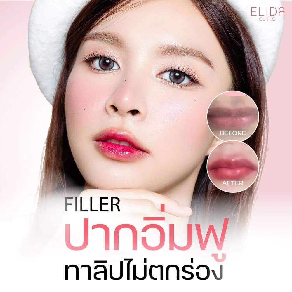 ELIDA_ image 38